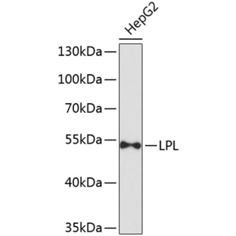 Western Blot - Anti-LPL Antibody (A9228) - Antibodies.com