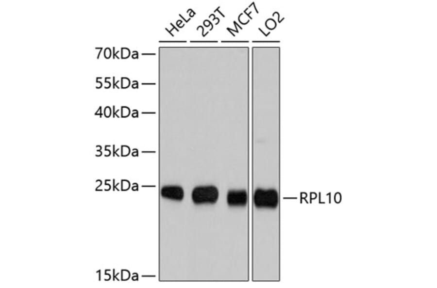 Western Blot - Anti-RPL10 Antibody (A9233) - Antibodies.com