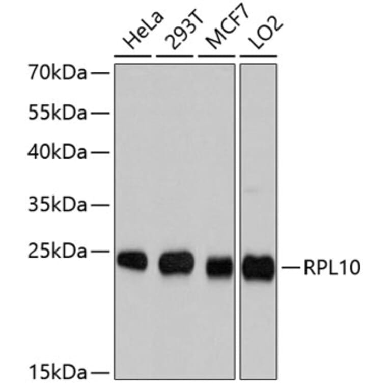 Western Blot - Anti-RPL10 Antibody (A9233) - Antibodies.com