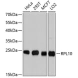 Western Blot - Anti-RPL10 Antibody (A9233) - Antibodies.com