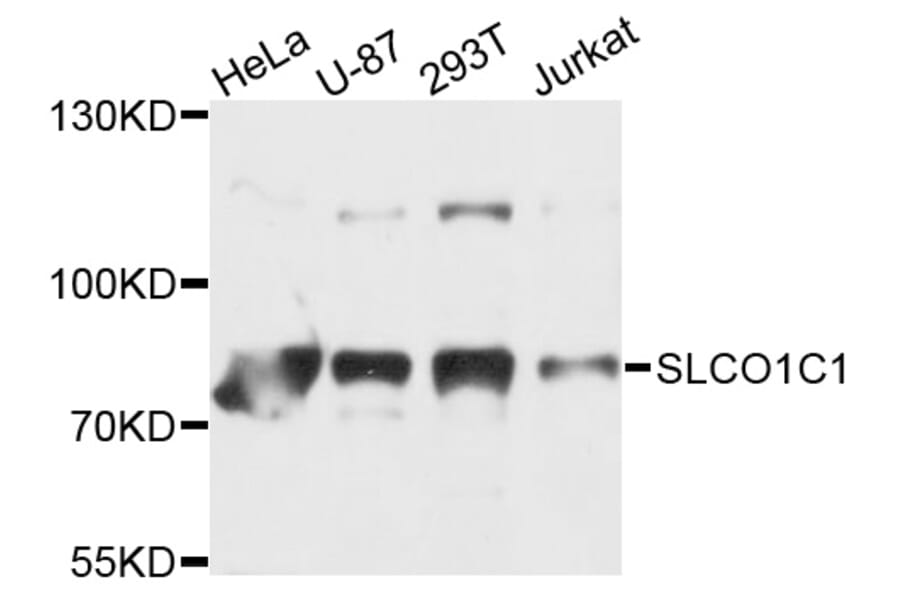 Western Blot - Anti-SLCO1C1 Antibody (A9248) - Antibodies.com