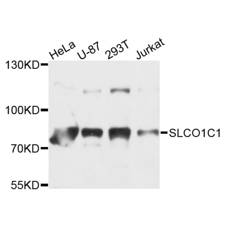 Western Blot - Anti-SLCO1C1 Antibody (A9248) - Antibodies.com