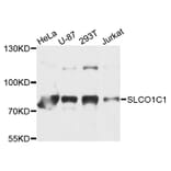 Western Blot - Anti-SLCO1C1 Antibody (A9248) - Antibodies.com