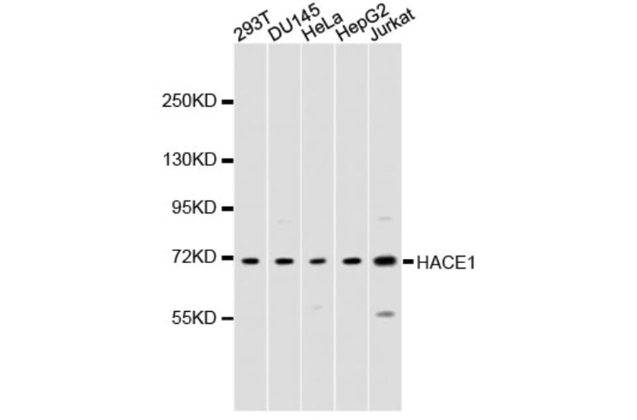 Western Blot - Anti-ZFP64 Antibody (A9253) - Antibodies.com