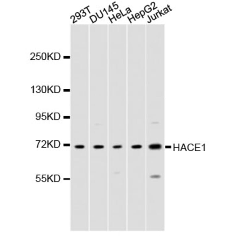 Western Blot - Anti-ZFP64 Antibody (A9253) - Antibodies.com