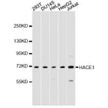 Western Blot - Anti-ZFP64 Antibody (A9253) - Antibodies.com