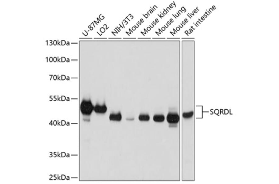 Western Blot - Anti-SQRDL Antibody (A10658) - Antibodies.com