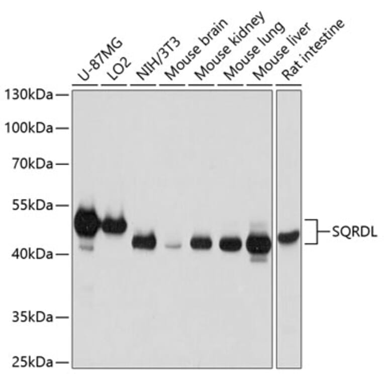 Western Blot - Anti-SQRDL Antibody (A10658) - Antibodies.com