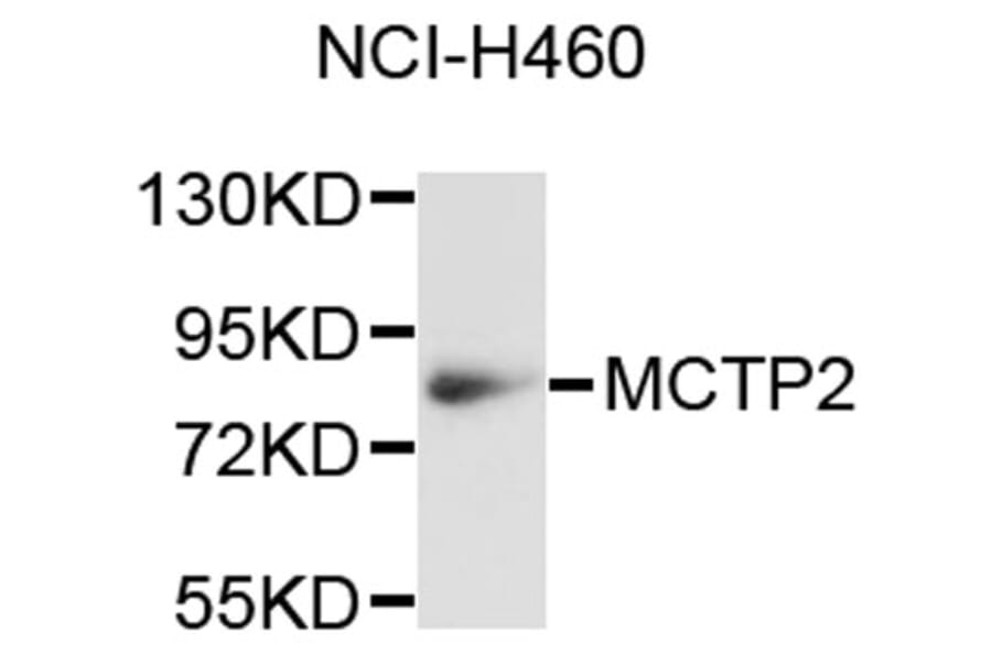 Western Blot - Anti-MCTP2 Antibody (A9280) - Antibodies.com