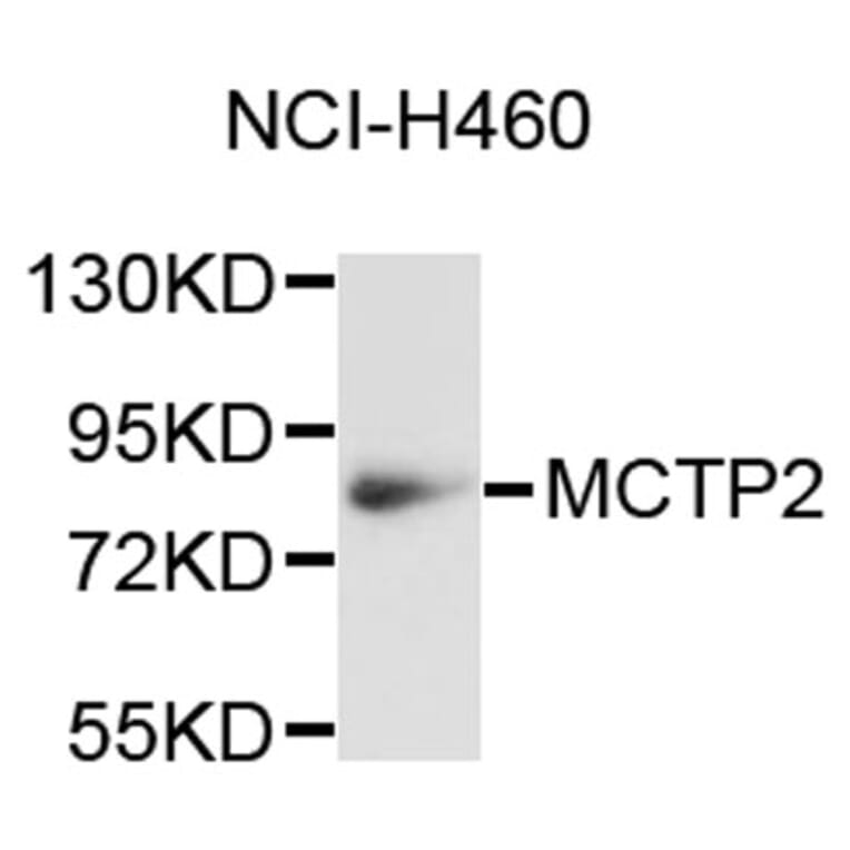 Western Blot - Anti-MCTP2 Antibody (A9280) - Antibodies.com