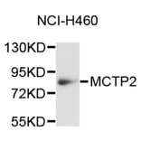Western Blot - Anti-MCTP2 Antibody (A9280) - Antibodies.com
