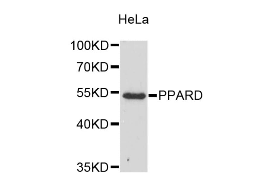 Western Blot - Anti-KLF17 Antibody (A9283) - Antibodies.com