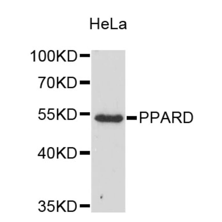 Western Blot - Anti-KLF17 Antibody (A9283) - Antibodies.com