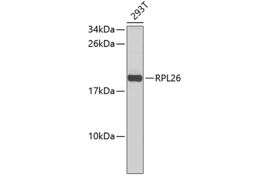 Western Blot - Anti-RPL26 Antibody (A9284) - Antibodies.com