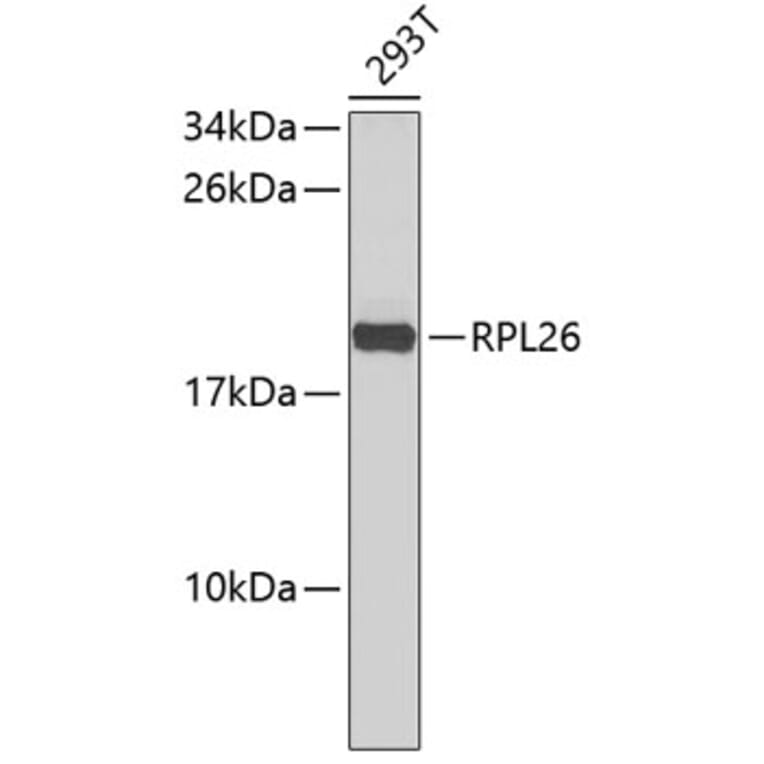 Western Blot - Anti-RPL26 Antibody (A9284) - Antibodies.com