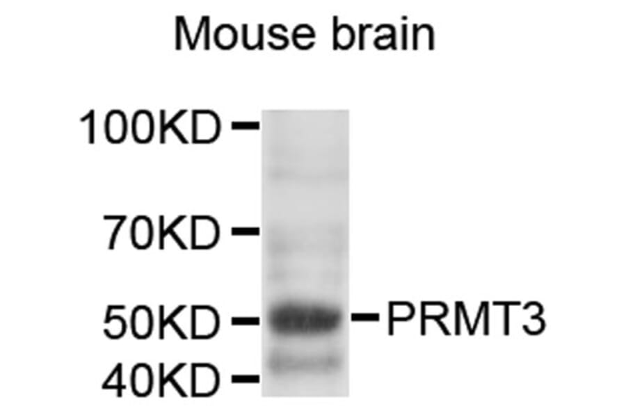 Western Blot - Anti-PRMT3 Antibody (A9285) - Antibodies.com