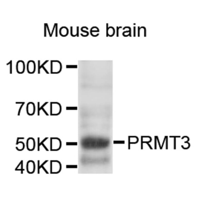 Western Blot - Anti-PRMT3 Antibody (A9285) - Antibodies.com