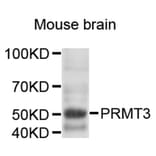 Western Blot - Anti-PRMT3 Antibody (A9285) - Antibodies.com