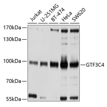 Western Blot - Anti-GTF3C4 Antibody (A9287) - Antibodies.com