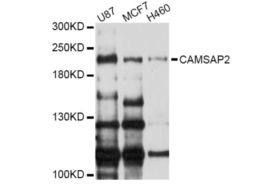 Western Blot - Anti-CAMSAP2 Antibody (A9315) - Antibodies.com