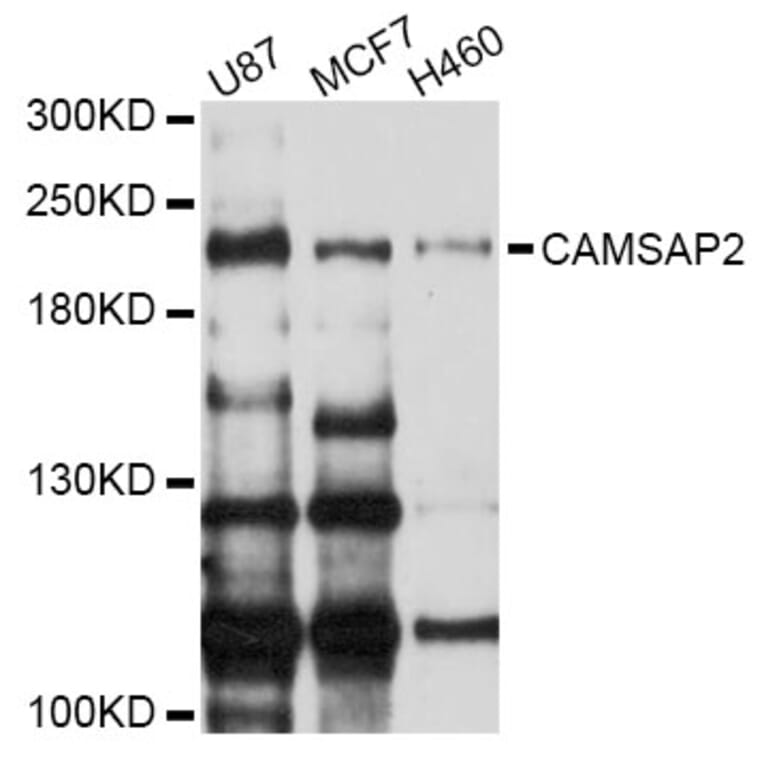 Western Blot - Anti-CAMSAP2 Antibody (A9315) - Antibodies.com