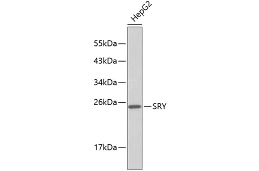 Western Blot - Anti-SRY Antibody (A9323) - Antibodies.com