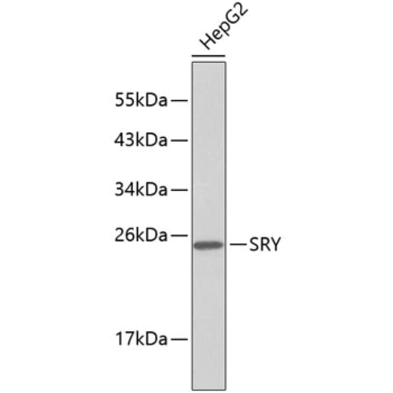 Western Blot - Anti-SRY Antibody (A9323) - Antibodies.com