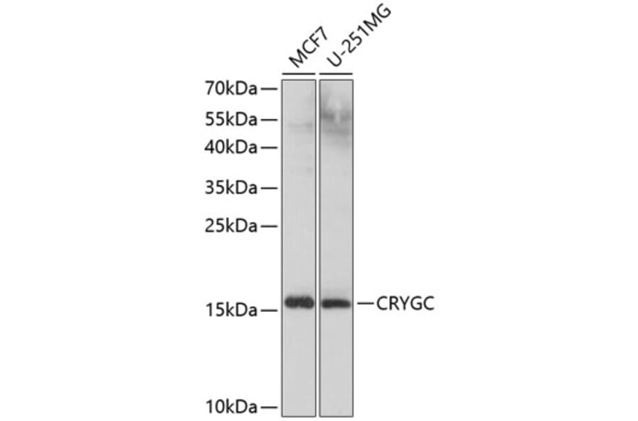 Western Blot - Anti-Gamma C Crystallin Antibody (A10671) - Antibodies.com