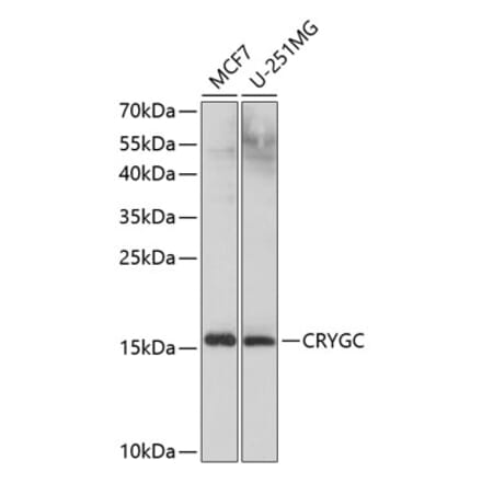 Western Blot - Anti-Gamma C Crystallin Antibody (A10671) - Antibodies.com