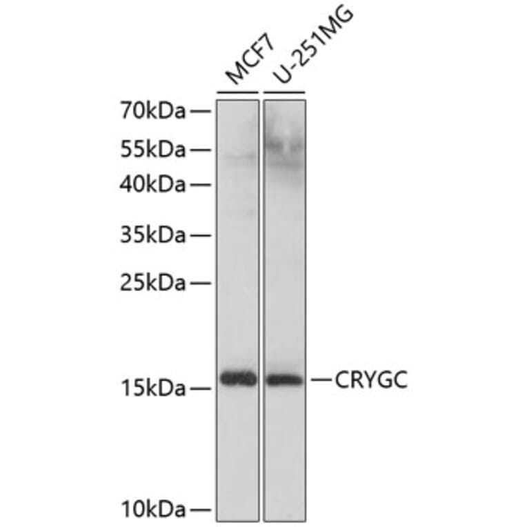 Western Blot - Anti-Gamma C Crystallin Antibody (A10671) - Antibodies.com