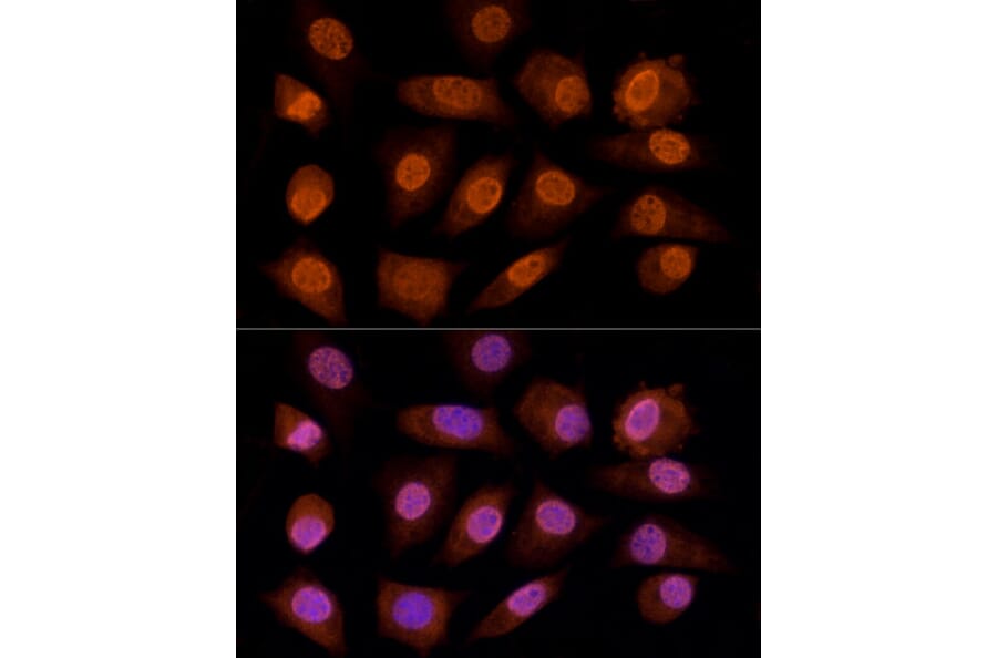 Immunofluorescence - Anti-Gamma C Crystallin Antibody (A10671) - Antibodies.com