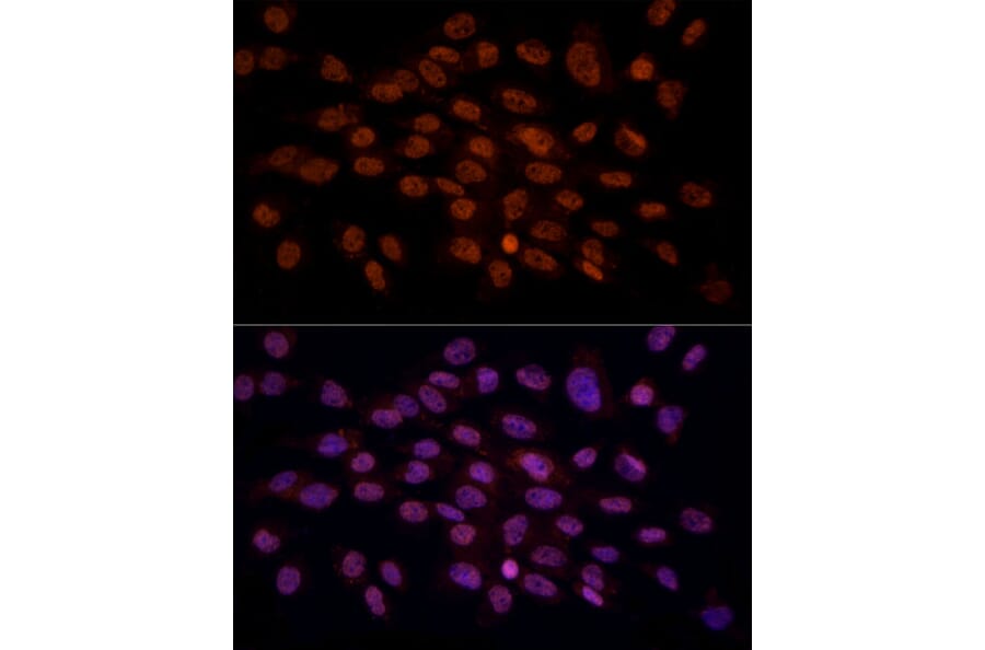 Immunofluorescence - Anti-Gamma C Crystallin Antibody (A10671) - Antibodies.com