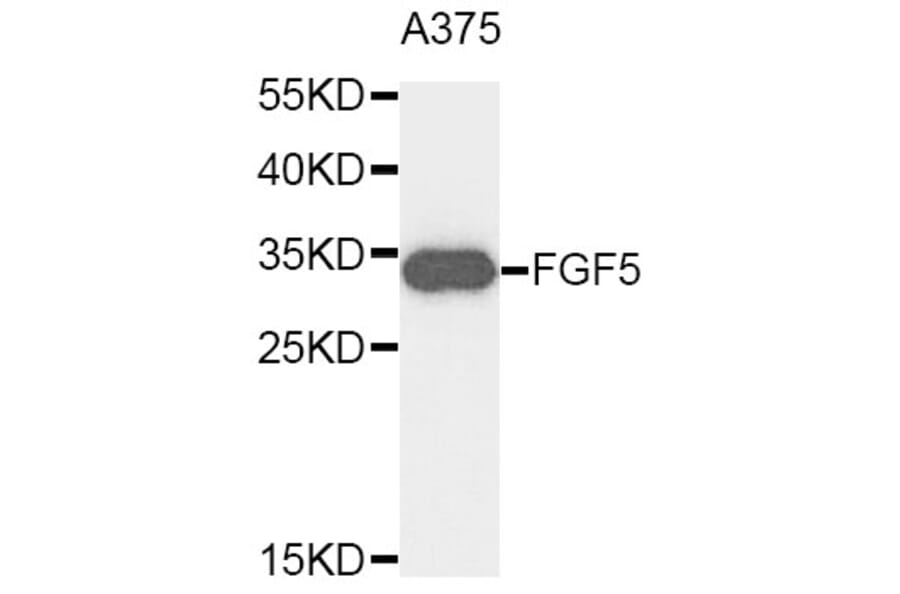 Western Blot - Anti-FGF5 Antibody (A9334) - Antibodies.com