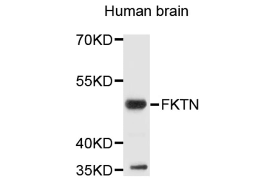 Western Blot - Anti-FKTN Antibody (A9344) - Antibodies.com