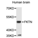 Western Blot - Anti-FKTN Antibody (A9344) - Antibodies.com