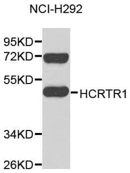 Western blot analysis of extracts of NCI-H292 cells, using Anti-HCRTR1 Antibody (A9349).
Secondary antibody: Goat Anti-Rabbit IgG (H+L) (HRP) (AS014) at 1:10,000 dilution.
Lysates / proteins: 25µg per lane.
Blocking buffer: 3% non-fat dry milk in TBST.
