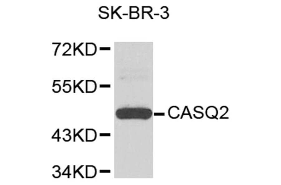 Western Blot - Anti-CASQ2 Antibody (A9350) - Antibodies.com