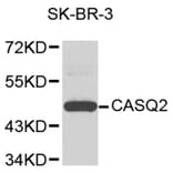 Western Blot - Anti-CASQ2 Antibody (A9350) - Antibodies.com