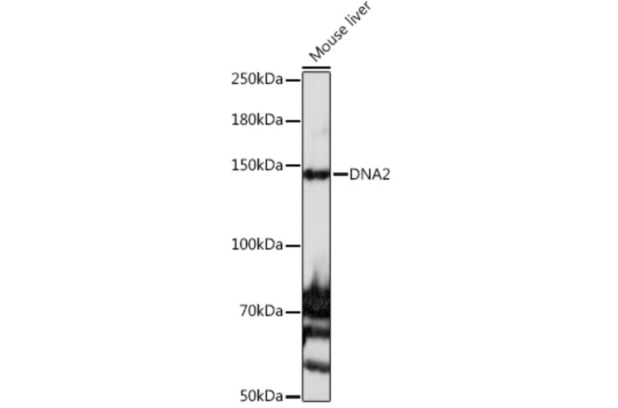 Western Blot - Anti-DNA2 Antibody (A10681) - Antibodies.com