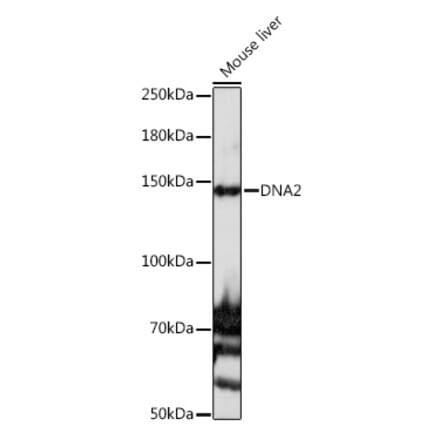 Western Blot - Anti-DNA2 Antibody (A10681) - Antibodies.com