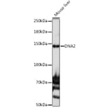 Western Blot - Anti-DNA2 Antibody (A10681) - Antibodies.com