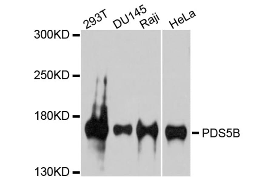 Western Blot - Anti-PDS5B Antibody (A9357) - Antibodies.com