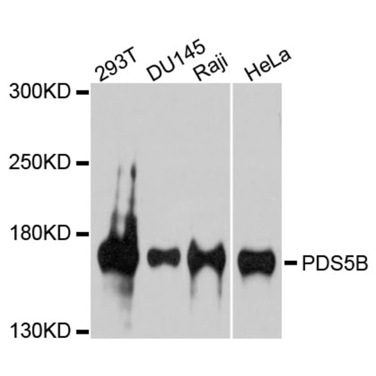 Western Blot - Anti-PDS5B Antibody (A9357) - Antibodies.com