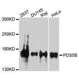 Western Blot - Anti-PDS5B Antibody (A9357) - Antibodies.com