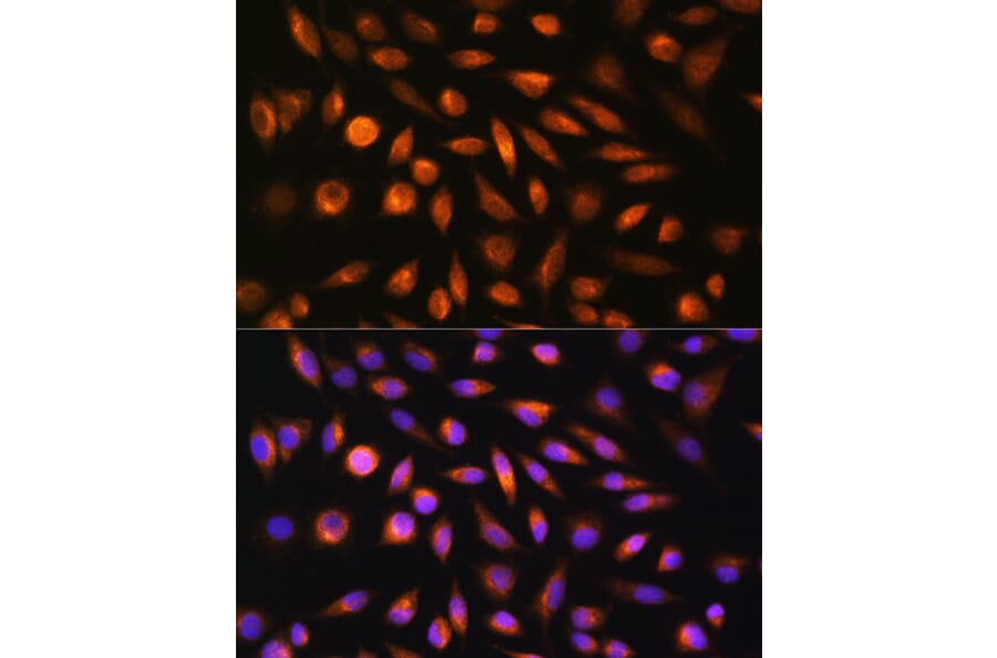Immunofluorescence - Anti-SH3PXD2A Antibody (A10684) - Antibodies.com