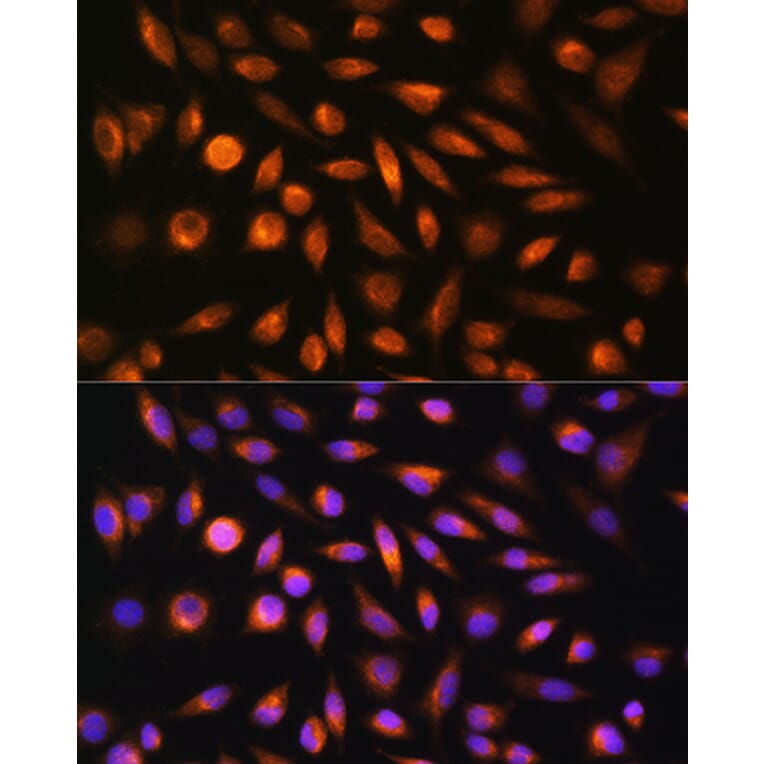 Immunofluorescence - Anti-SH3PXD2A Antibody (A10684) - Antibodies.com