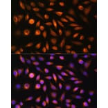 Immunofluorescence - Anti-SH3PXD2A Antibody (A10684) - Antibodies.com