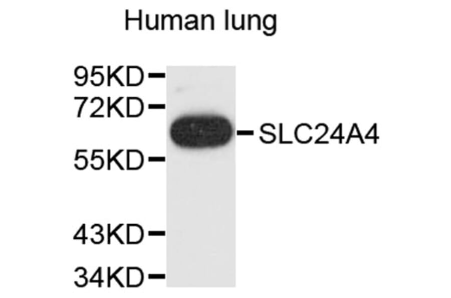 Western Blot - Anti-SLC24A4 Antibody (A9364) - Antibodies.com