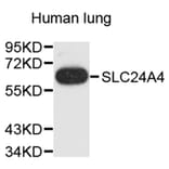 Western Blot - Anti-SLC24A4 Antibody (A9364) - Antibodies.com