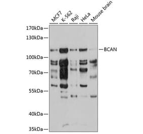 Western Blot - Anti-Brevican Antibody (A10687) - Antibodies.com